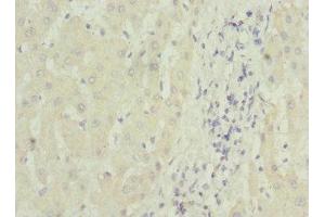 Immunohistochemistry of paraffin-embedded human liver tissue using ABIN7159842 at dilution of 1:100 (MTCH1 antibody  (AA 100-250))
