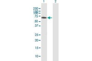 Western Blot analysis of ZMYND11 expression in transfected 293T cell line by ZMYND11 MaxPab polyclonal antibody. (ZMYND11 antibody  (AA 1-508))