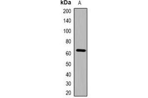Western blot analysis of Cytokeratin-pan expression in mouse lung (A) whole cell lysates. (pan Keratin antibody)