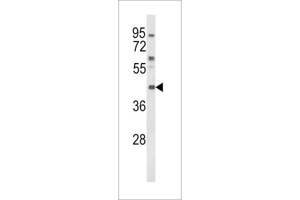 MC3R anticorps  (AA 86-112)