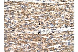 PNPLA3 antibody was used for immunohistochemistry at a concentration of 4-8 ug/ml to stain Myocardial cells (arrows) in Human Heart. (PNPLA3 antibody  (C-Term))
