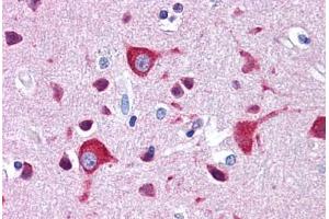 Human Brain, Cortex: Formalin-Fixed, Paraffin-Embedded (FFPE) (ZEB2 antibody  (C-Term))