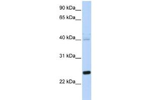 WB Suggested Anti-HSPB8 Antibody Titration: 0. (HSPB8 antibody  (N-Term))