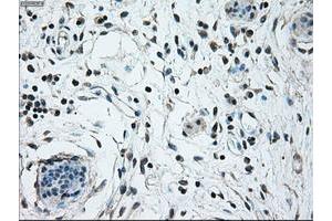 Image no. 2 for anti-Nuclear Receptor Binding Protein 1 (NRBP1) antibody (ABIN1499825) (NRBP1 antibody)