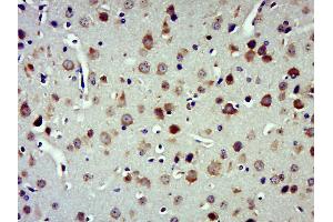 Immunohistochemistry (Paraffin-embedded Sections) (IHC (p)) image for anti-Insulin-Degrading Enzyme (IDE) (AA 491-590) antibody (ABIN723680)
