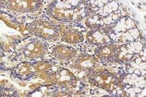 Immunohistochemistry analysis of paraffin-embedded rat colon using CD13(ABIN7072989) at dilution of 1:1000. (CD13 antibody)
