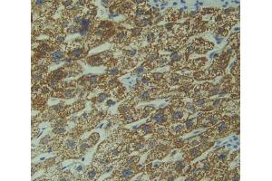 Used in DAB staining on fromalin fixed paraffin- embedded Kidney tissue (DIXDC1 antibody  (AA 485-683))