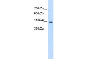 Western Blotting (WB) image for anti-Phosphate Cytidylyltransferase 2, Ethanolamine (PCYT2) antibody (ABIN2462716) (PCYT2 antibody)