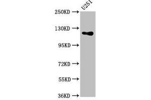 Western Blot Positive WB detected in: U251 whole cell lysate All lanes: GUCY2D antibody at 5.