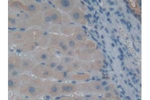 DAB staining on IHC-P; Samples: Human Liver Tissue (GLRX3 antibody  (AA 144-234))