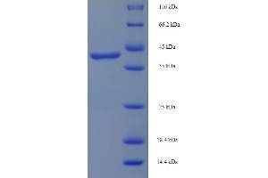 SDS-PAGE (SDS) image for DAG Kinase gamma (AA 1-255), (partial) protein (His-SUMO Tag) (ABIN5709399) (DGKG Protein (AA 1-255, partial) (His-SUMO Tag))