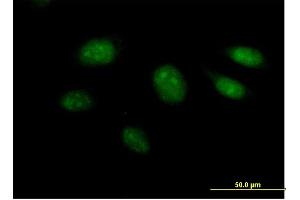 Immunofluorescence of purified MaxPab antibody to ARL3 on HeLa cell. (ARL3 antibody  (AA 1-182))