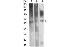 Western blot analysis using CD361 mouse mAb against HL-60 (1), Raji (2), and PC-12 (3) cell lysate. (EVI2B antibody  (AA 22-202))
