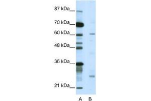 WB Suggested Anti-NR1I2 Antibody Titration:  5.