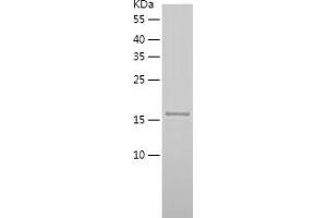 Western Blotting (WB) image for Dynactin 6 (DCTN6) (AA 1-190) protein (His tag) (ABIN7122718)
