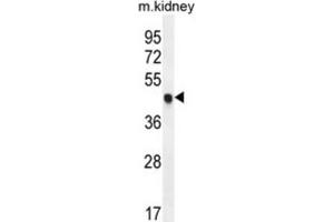 Western Blotting (WB) image for anti-Cyclin-Dependent Kinase Inhibitor 1C (p57, Kip2) (CDKN1C) antibody (ABIN2995933) (CDKN1C antibody)