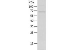 Western Blotting (WB) image for P-Cadherin (CDH3) (AA 108-654) protein (His tag) (ABIN7285664) (P-Cadherin Protein (CDH3) (AA 108-654) (His tag))