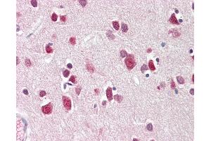 Immunohistochemistry (IHC) image for anti-Cbp/p300-Interacting Transactivator, with Glu/Asp-Rich Carboxy-terminal Domain, 2 (CITED2) (N-Term) antibody (ABIN1804228)