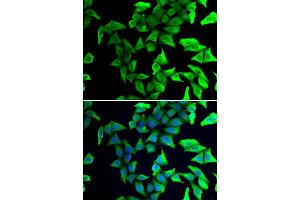 Immunofluorescence analysis of U2OS cells using VSNL1/VILIP-1 antibody (ABIN3016717, ABIN3016718, ABIN3016719 and ABIN6219826). (VSNL1 antibody  (AA 1-191))
