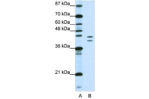 WB Suggested Anti-HNRPD  Antibody Titration: 1. (HNRNPD/AUF1 antibody  (N-Term))