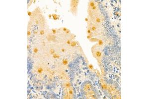 Immunohistochemistry of paraffin embedded mouse duodenum using CLCA1 (ABIN7073472) at dilution of 1:700 (400x lens) (CLCA1 antibody)