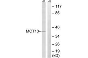 Western blot analysis of extracts from Jurkat cells, using MOT13 Antibody. (SLC16A13 antibody  (AA 377-426))