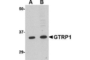 Western Blotting (WB) image for anti-Growth Hormone Regulated TBC Protein 1 (GRTP1) (N-Term) antibody (ABIN1031398) (GRTP1 antibody  (N-Term))