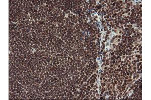 Image no. 13 for anti-Replication Factor C (Activator 1) 2, 40kDa (RFC2) (AA 1-234) antibody (ABIN1490617)