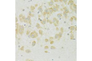 Immunohistochemistry of paraffin-embedded rat brain using SLC37A4 antibody (ABIN6292412) at dilution of 1:100 (40x lens).