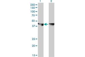 Western Blot analysis of MAPK3 expression in transfected 293T cell line by MAPK3 monoclonal antibody (M01), clone 3C9. (ERK1 antibody  (AA 279-379))