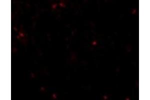 Immunofluorescence using anti Occludinon human liver tissue at 20µg/ml (Occludin antibody  (C-Term))