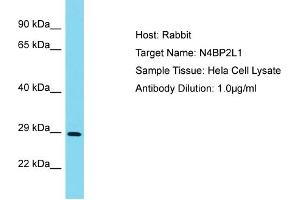 Host: Rabbit Target Name: N4BP2L1 Sample Type: Hela Whole Cell lysates Antibody Dilution: 1. (N4BP2L1 antibody  (N-Term))