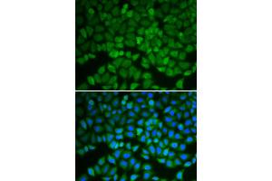 Immunofluorescence analysis of A549 cells using GSS antibody (ABIN6290429). (Glutathione Synthetase antibody)