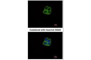 ICC/IF Image Immunofluorescence analysis of methanol-fixed Hep G2, using mtRNA polymerase, antibody at 1:500 dilution. (POLRMT antibody  (Center))