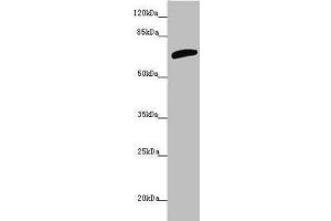 Western blot All lanes: SLC6A12 antibody at 4.