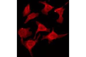 ABIN6274572 staining HeLa by IF/ICC. (Serotonin Receptor 2B antibody  (Internal Region))