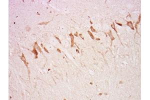 Paraformaldehyde-fixed, paraffin embedded rat brain, Antigen retrieval by boiling in sodium citrate buffer (pH6) for 15min, Block endogenous peroxidase by 3% hydrogen peroxide for 30 minutes, Blocking buffer (normal goat serum) at 37°C for 20min, Antibody incubation with Rabbit Anti-Neurofascin Polyclonal Antibody, Unconjugated  at 1:500 overnight at 4°C, followed by a conjugated secondary and DAB staining. (NFASC antibody  (AA 501-650))