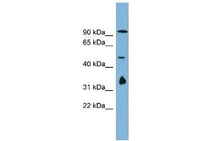 WB Suggested Anti-MAK10 Antibody Titration:  0. (MAK10/NAA35 antibody  (N-Term))