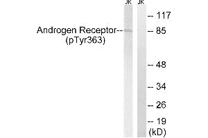 Western blot analysis of extracts from Jurkat cells, treated with UV (15mins), using Androgen Receptor (Phospho-Tyr363) antibody. (Androgen Receptor antibody  (pTyr363))