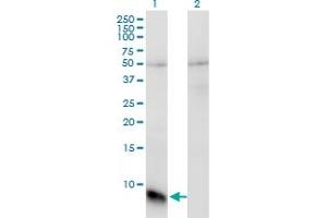 Western Blot analysis of GNGT1 expression in transfected 293T cell line by GNGT1 monoclonal antibody (M01), clone 1F8.