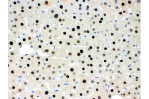 IHC analysis of RbAp48 using anti-RbAp48 antibody (ABIN3043920). (Retinoblastoma Binding Protein 4 antibody  (C-Term))