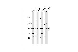 All lanes : Anti-IL12RB2 Antibody (C-term) at 1:2000 dilution Lane 1: THP-1 whole cell lysate Lane 2: A431 whole cell lysate Lane 3: Jurkat whole cell lysate Lane 4: MOLT-4 whole cell lysate Lysates/proteins at 20 μg per lane. (IL12_2 (AA 756-783), (C-Term) antibody)