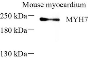 Western blot analysis of MYH7 (ABIN7075623),at dilution of 1: 600 (Slow Skeletal Myosin Heavy Chain antibody)