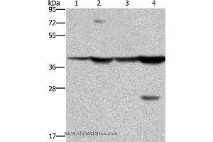 Western blot analysis of Mouse stomach and human fetal liver tissue, MCF-7 cell and mouse liver tissue, using FBP1 Polyclonal Antibody at dilution of 1:850 (FBP1 antibody)