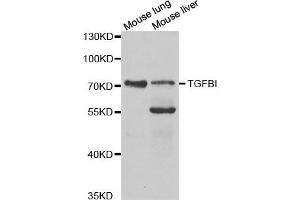 Western Blotting (WB) image for anti-Transforming Growth Factor, beta-Induced, 68kDa (TGFBI) antibody (ABIN1875076)