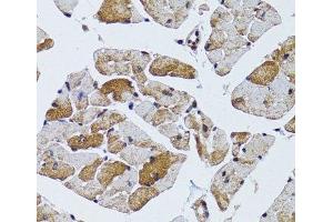 Immunohistochemistry of paraffin-embedded Mouse heart using MRPS6 Polyclonal Antibody at dilution of 1:100 (40x lens). (MRPS6 antibody)