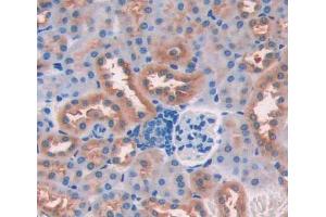 Used in DAB staining on fromalin fixed paraffin- embedded kidney tissue (CDK18 antibody  (AA 121-402))