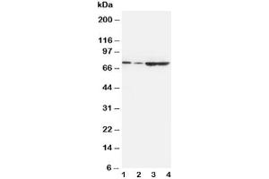 Western blot testing of PCSK9 antibody and Lane 1:  A549 (PCSK9 antibody  (AA 671-687))