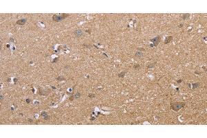 Immunohistochemistry of paraffin-embedded Human brain using MAPRE3 Polyclonal Antibody at dilution of 1:50 (MAPRE3 antibody)