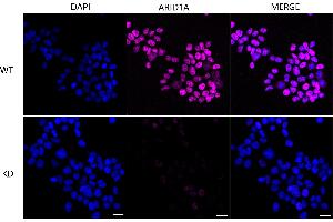 Immunocytochemical staining of Hela cells using ARID1A antibody (ABIN7797666), 1:1,000), Top panel: wild-type (WT), Bottom panal: ARID1A shRNA knockdown (KD).